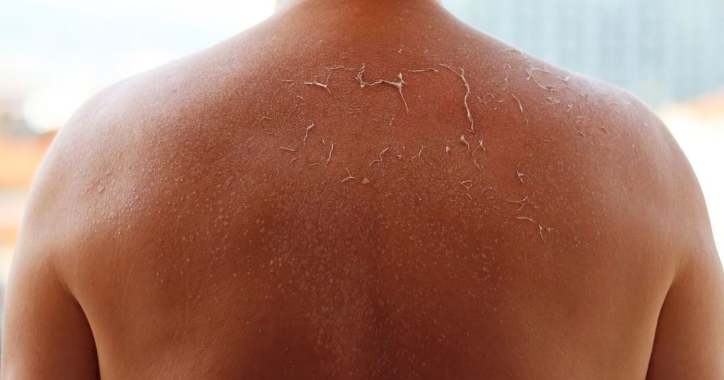 なぜ今男性に紫外線対策が必要なのか？メンズ肌の真実とUVケアの重要性